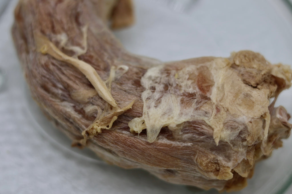 Turkey Neck