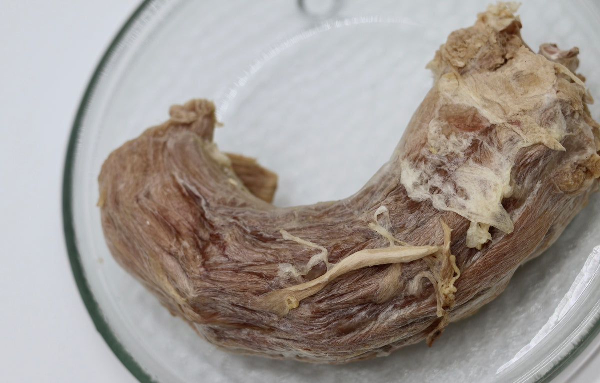 Turkey Neck